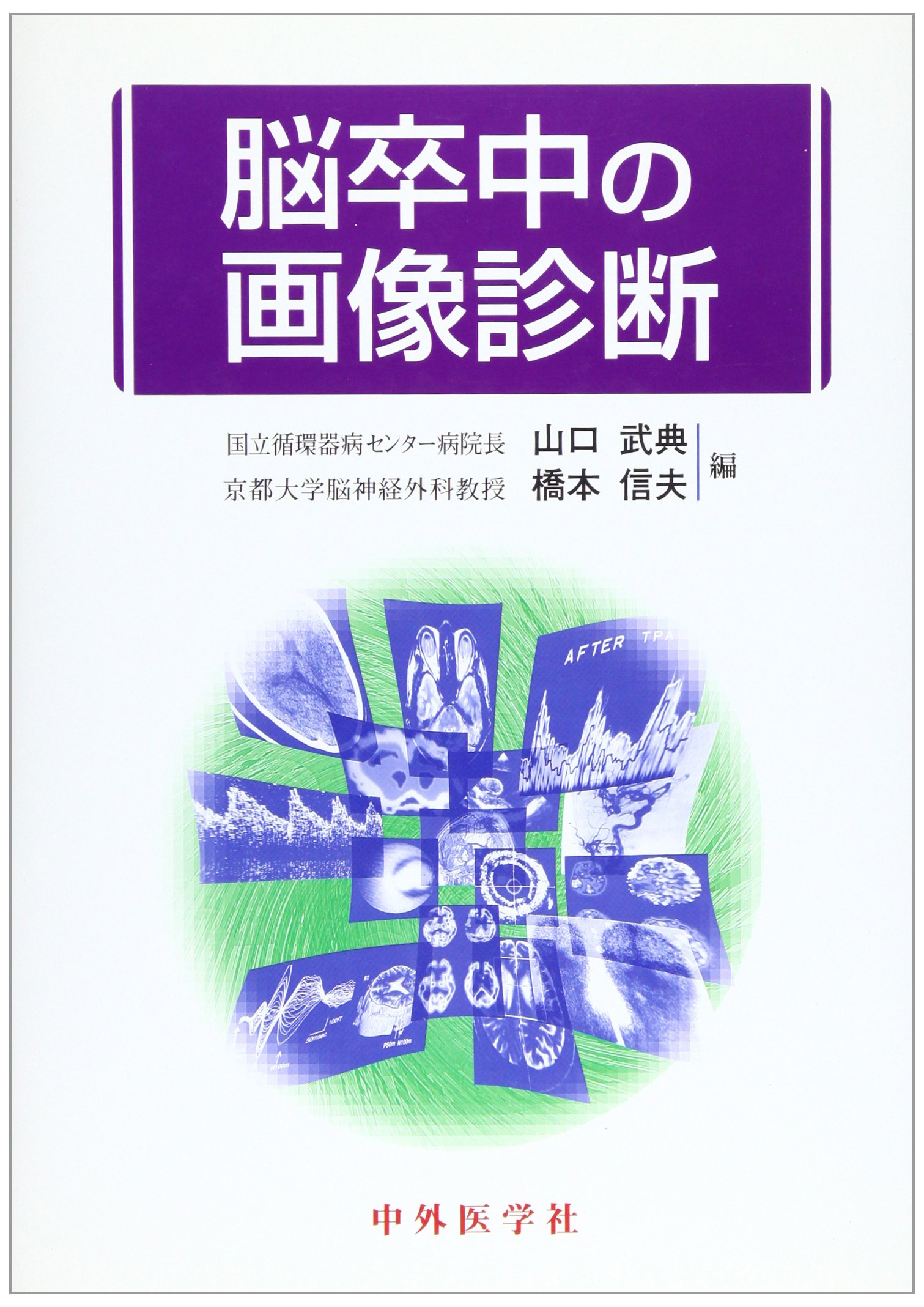 中古 中外医学社 脳血管障害の画像診断 脳卒中の画像診断 | 山口武典, 橋本信夫 |本 | 通販 | Amazon